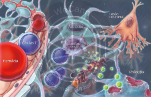 Efeitos da Cannabis na Excitabilidade Cerebral 3 Neuroinflamação crônica e prolongada pode culminar em neurodegeneração e morte neuronal. Fonte: MONTAGNER, Patrícia; DE SALAS-QUIROGA, Adán. Tratado de Medicina Endocanabinoide.1. ed. WeCann Endocannabinoid Global Academy, 2023.