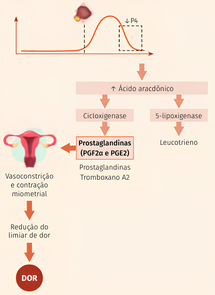 CBD e Cólica Menstrual: Uma análise da eficácia terapêutica 1 Fisiopatologia da dismenorreia primária. Fonte: TRONCON, Júlia Kefalás; ROSA-E-SILVA, Ana Carolina Japur de Sá; REIS, Rosana Maria dos. Dismenorreia: abordagem diagnóstica e terapêutica. Publicação Oficial da Federação Brasileira das Associações de Ginecologia e Obstetrícia, v. 48, n. 9, 2020.