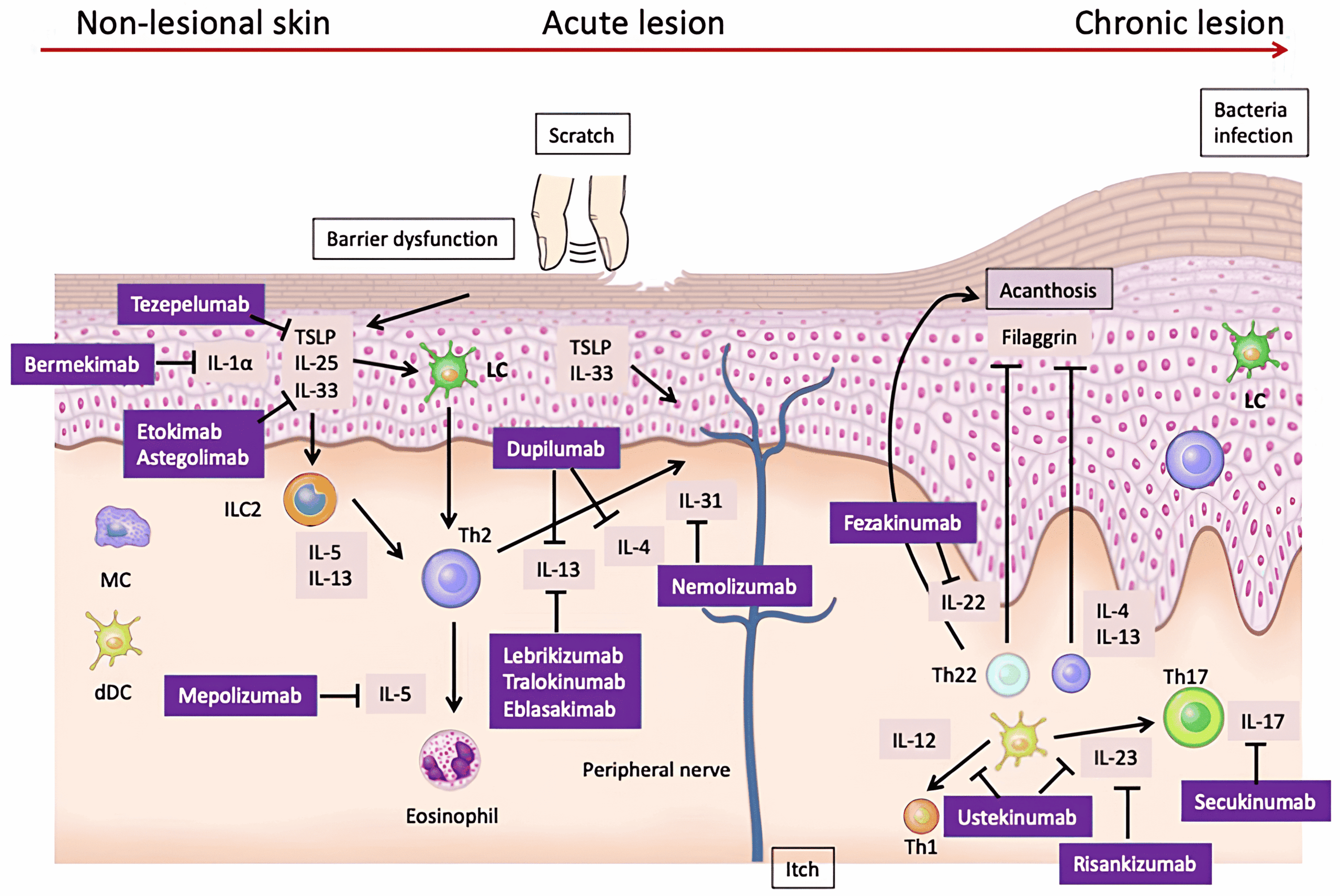O papel dos canabinoides na Dermatite Atópica 1 Patogênese e alvos terapêuticos da dermatite atópica: evidências de modelos murinos e humanos. Fonte: YAMAMURA, Yuto; NAKASHIMA, Chisa; OTSUKA, Atsushi. Interplay of cytokines in the pathophysiology of atopic dermatitis: insights from murine models and human. Frontiers in Medicine, v. 11, 2024.